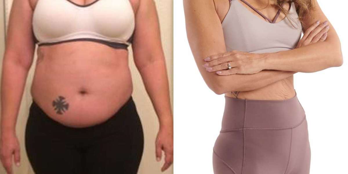 Weight Loss Capsules