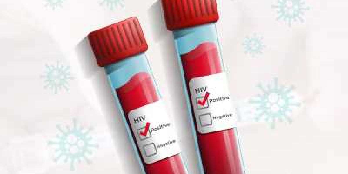 HIV Diagnostics Market Analysis Till 2029